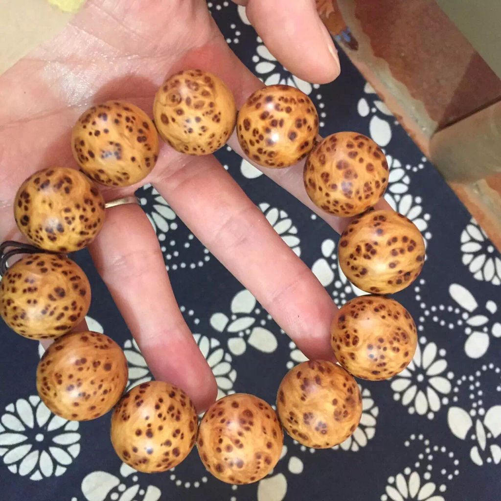 患有结核病的人可以活多久 结核病吃什么好-ayx官网(图1) 爱游戏(ayx)中国官方网站